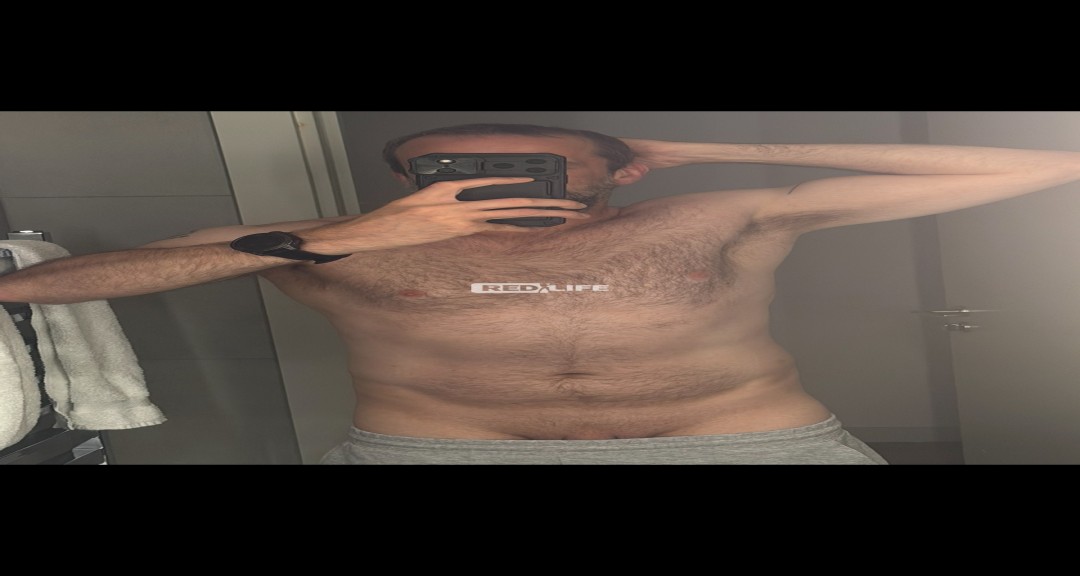 45 years old, currently slimming